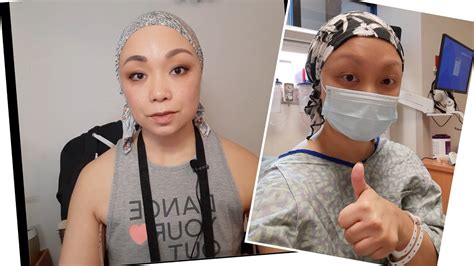 Week 3 Recovery Bilateral Mastectomy With Chest Expanders Youtube