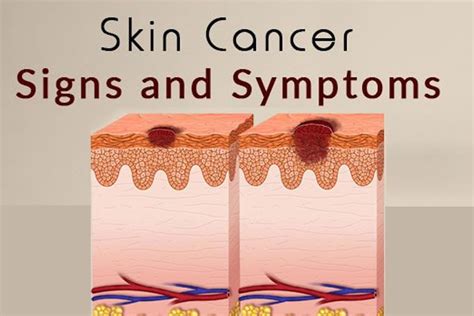 Symptoms Of Skin Cancer On Face