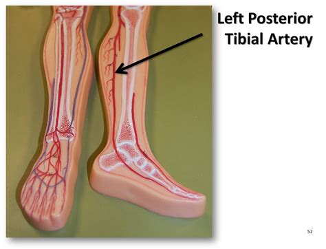 Tibial Artery Anatomy