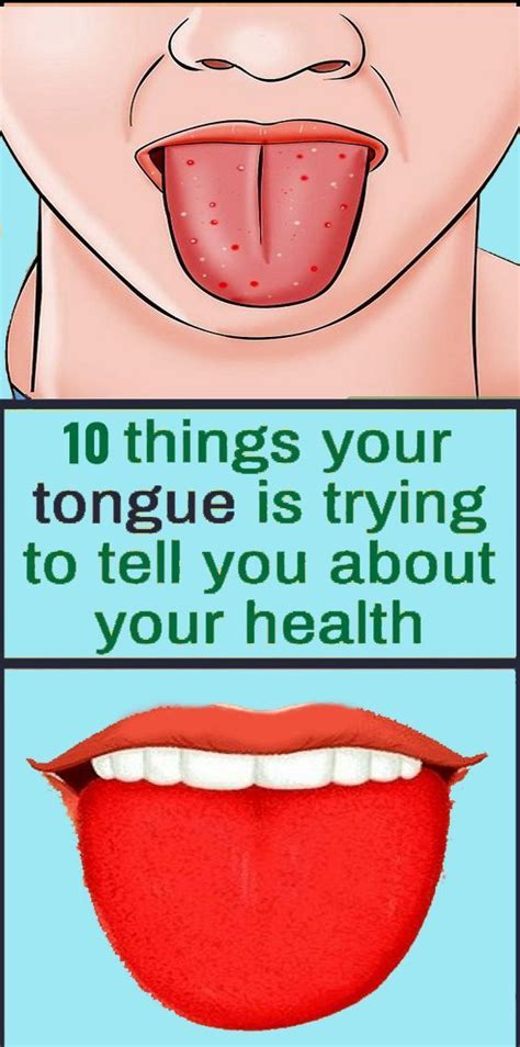 What Your Tongue Says About Your Health Health Coconut Health