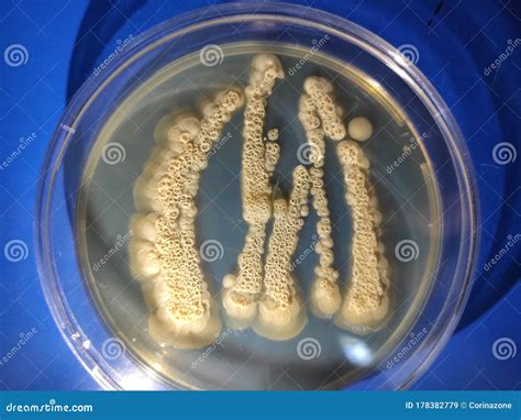 Candida Albicans Growing On Sabouraud Dextrose Agar Medium Stock Image