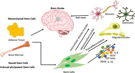 Rightways To Success Application Of Stem Cells In Stroke A