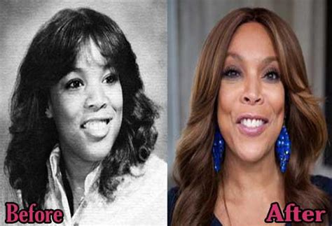 Wendy Williams Plastic Surgery Before And After Photos Top Piercings