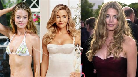 Denise Richards Before And After Plastic Surgery Youtube