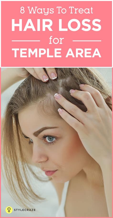8 Simple Ways To Treat Hair Loss At The Temples Temple Hair Loss