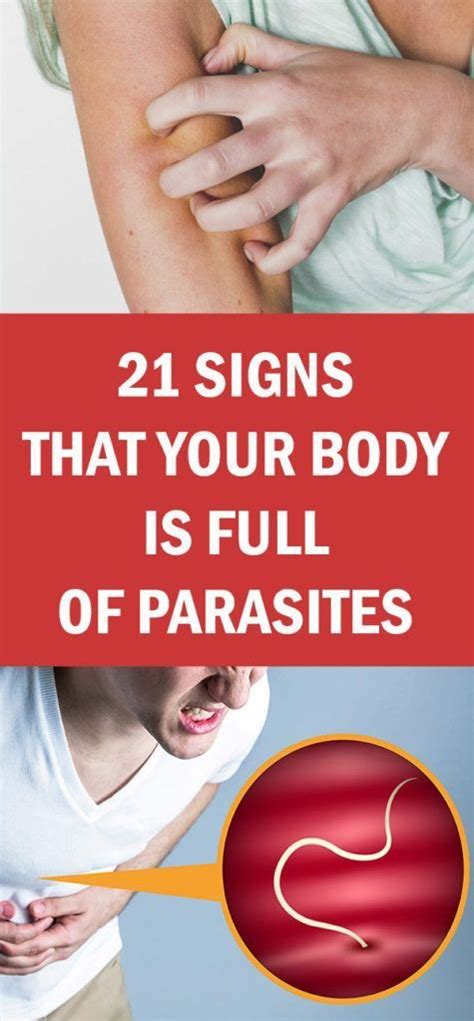 21 Signs That Your Body Is Full Of Parasites Mooseteaparty