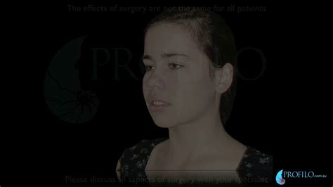 Check spelling or type a new query. Before and After Orthognathic Jaw Surgery Overbite ...