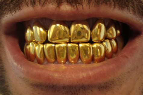 Gold Teeth Usa Miami Fl