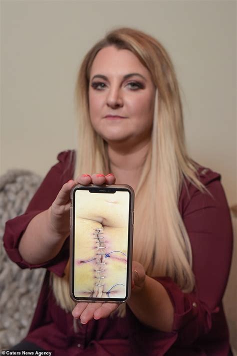 Businesswoman 35 Nearly Died Four Times After Her Placenta Grew In
