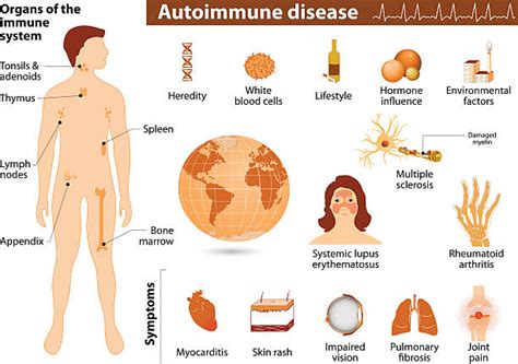 There are more than 100 autoimmune diseases, including conditions such as celiac disease, type 1 diabetes, and psoriasis. Royalty Free Lymphatic System Clip Art, Vector Images ...