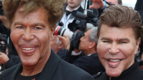 Igor And Grichka Bogdanoff Extreme Plastic Surgery Disasters And Why They Do It Herald Sun