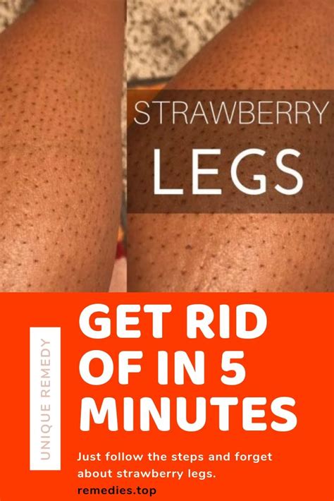 Are You Ready To Get Rid Of Strawberry Legs In 5 Easy Steps