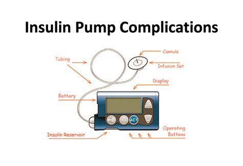 emDOCs.net – Emergency Medicine EducationInsulin Pumps: Complications