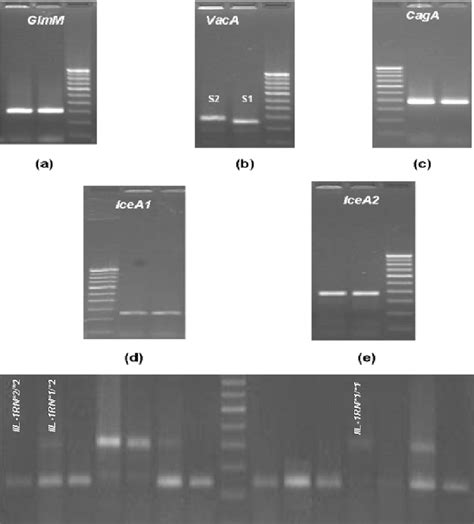 Pcr Amplification Of H Pylori Genes Glmm A Vaca S Region B Caga Download Scientific