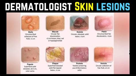Dermatologist Skin Lesions Clinical Features Dermatology ا ردو