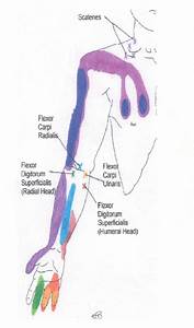 Neck Shoulder Arm And Hand Trigger Point Chart 2 Copyright