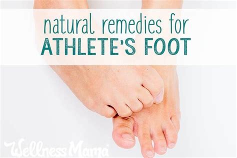 5 Effective Natural Ways To Remedy Athletes Foot For Good In 2020