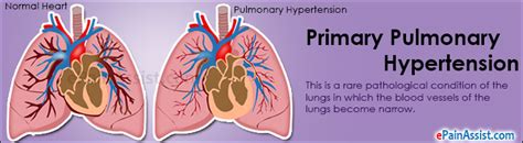 Primary Pulmonary Hypertension Treatment And Symptoms
