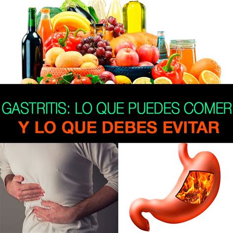 Gastritis Lo Que Puedes Comer Y Lo Que Debes Evitar Remedios Caseros