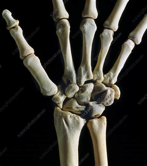 Bones Of The Wrist Joint Stock Image P1160119 Science Photo Library