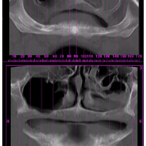 Computerized Tomography View Download Scientific Diagram