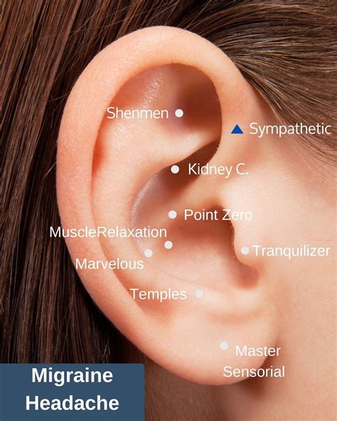 Ear Seeds Info — Three Tides Massage Acupuncture Naturopath Physiotherapy Homeopathy