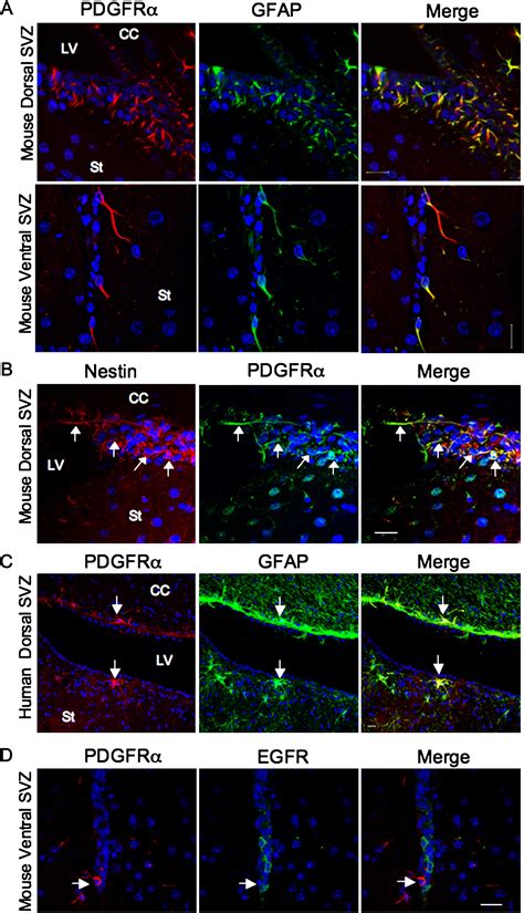 Pdgfrα Positive B Cells Are Neural Stem Cells In The Adult Svz That