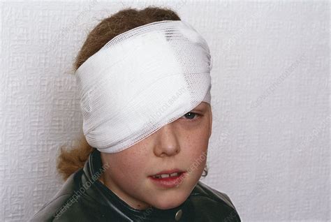 Bandaged Eye Stock Image M526 0199 Science Photo Library