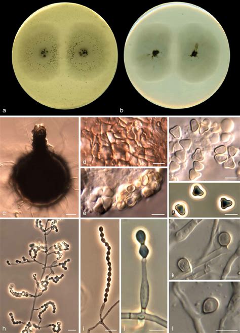 Microascus Alveolaris Cbs 139501 A B Colonies On Oa And Pca