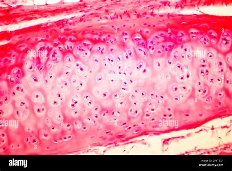 Hyaline Cartilage Of Human Trachea Light Micrograph Stock Photo Alamy