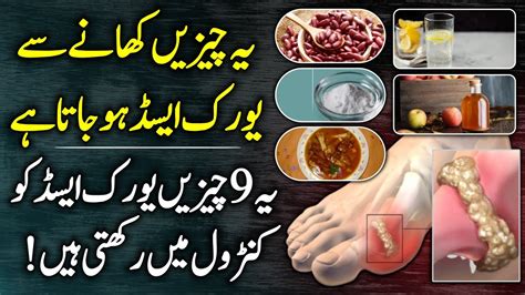 9 Best Foods For Uric Acid Treatment And Symptoms Of Uric Acid In Urdu Hindi Youtube