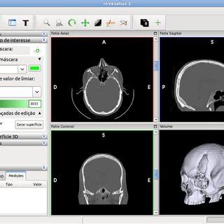 Disponível para as plataformas microsoft windows. (PDF) InVesalius: Software Livre de Imagens Médicas