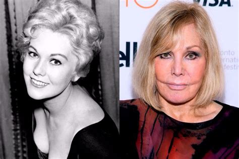 Kim Novak Now And Then Kim Novak Before And After Plastic Surgery