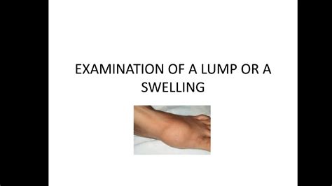 Examination Of A Lump Or A Swelling Youtube