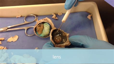 Cow Eye Dissection Youtube