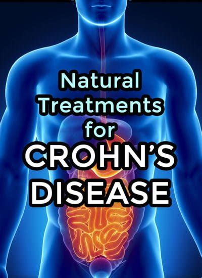 Treating Crohns Disease Naturally Through Ginger And Turmeric