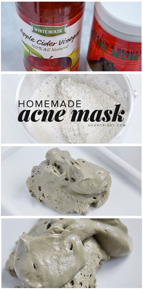 Diy Acne Mask Detoxify Unclog Pores And Clear Your Skin Homemade