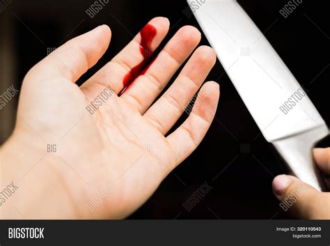 Finger Cut Bleeding Image And Photo Free Trial Bigstock