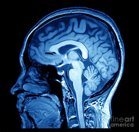 Magnetic Resonance Image Mri Of The Photograph By Mriman