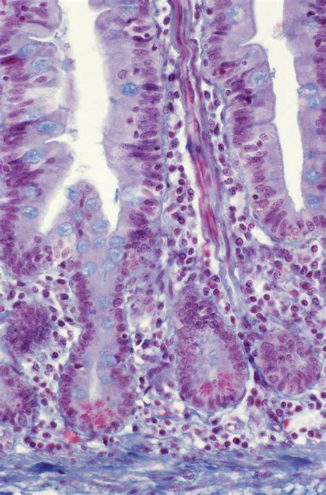 The small intestine, despite its name, is the longest part of the gastrointestinal tract. Small intestine lining - Stock Image - P520/0146 - Science ...