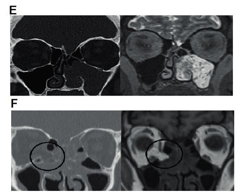 Representative Images Of Anatomical Structures On Mri And Cta The
