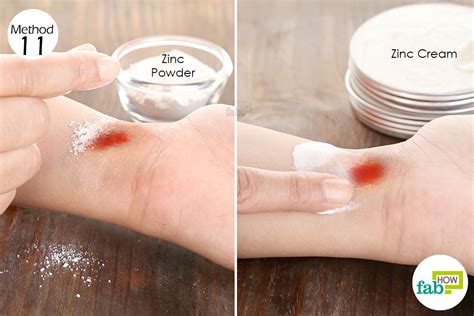 How To Heal Minor Wounds Quickly Fab How