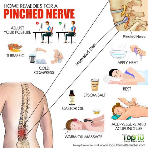 Treatment For Pinched Nerve In Back Hobi Akuarium