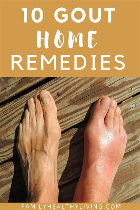 Pin On Natural Home Remedies