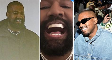 Kanye West Replaces Teeth With James Bond Inspired 850k Titanium Dentures
