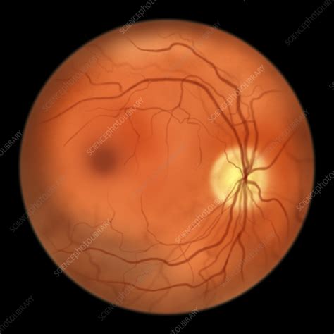 Healthy Retina Illustration Stock Image F0364330 Science Photo