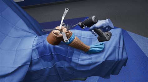 Practice makes perfect: How VR is revolutionizing surgical training - AIVAnet