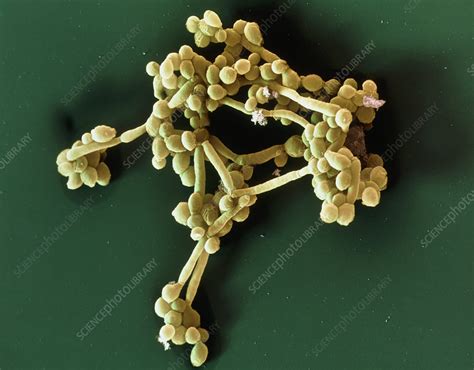 Candida Albicans Fungus Sem Stock Image B2501000 Science Photo