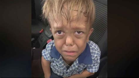 Mother Posts Heartbreaking Video Of Son With Dwarfism Sobbing After