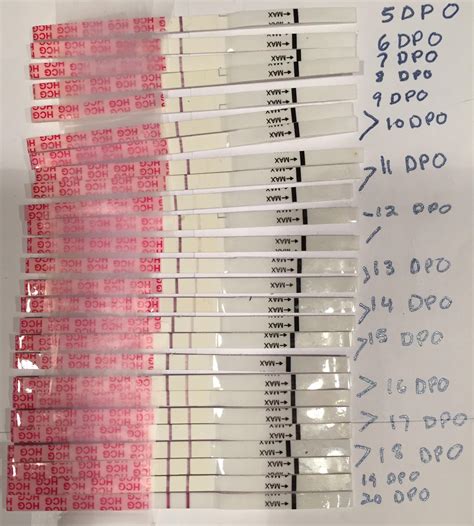 Line Progression Wondfo Dpo 5 20 Hcg Beta Was 299 At 16dpo And 764